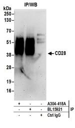 CD28 Antibody in Immunoprecipitation (IP)