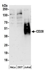 CD28 Antibody in Western Blot (WB)