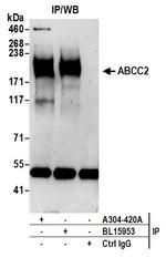 ABCC2 Antibody in Immunoprecipitation (IP)