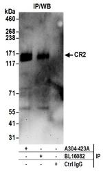 CR2 Antibody in Immunoprecipitation (IP)