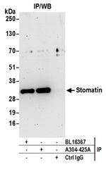 Stomatin Antibody in Immunoprecipitation (IP)