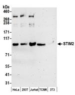 STIM2 Polyclonal Antibody