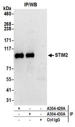STIM2 Antibody in Immunoprecipitation (IP)
