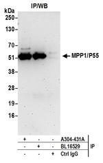 MPP1/P55 Antibody in Immunoprecipitation (IP)