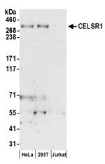 CELSR1 Polyclonal Antibody