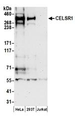CELSR1 Polyclonal Antibody