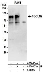 TGOLN2 Antibody in Immunoprecipitation (IP)