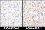 LAS1L Antibody in Immunohistochemistry (Paraffin) (IHC (P))