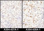 LAS1L Polyclonal Antibody