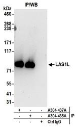 LAS1L Antibody in Immunoprecipitation (IP)
