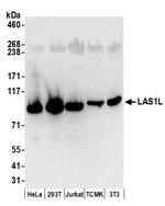 LAS1L Antibody in Western Blot (WB)