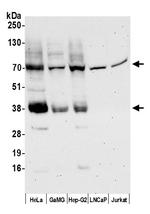 MCT4 Polyclonal Antibody