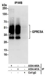 GPRC5A Polyclonal Antibody