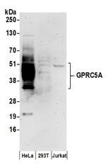 GPRC5A Polyclonal Antibody