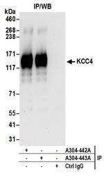 KCC4 Antibody in Immunoprecipitation (IP)