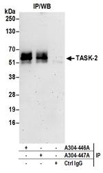 TASK-2 Antibody in Immunoprecipitation (IP)