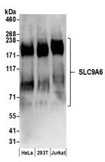 SLC9A6 Polyclonal Antibody