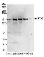 PTK7 Polyclonal Antibody