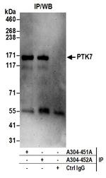 PTK7 Antibody in Immunoprecipitation (IP)