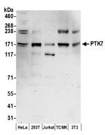 PTK7 Polyclonal Antibody