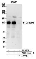 DCBLD2 Antibody in Immunoprecipitation (IP)