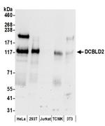 DCBLD2 Polyclonal Antibody