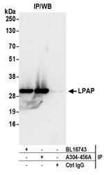 LPAP Antibody in Immunoprecipitation (IP)