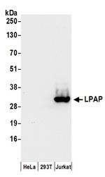 LPAP Polyclonal Antibody