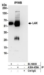 LAX Antibody in Immunoprecipitation (IP)