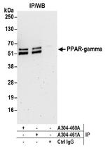 PPAR-gamma Polyclonal Antibody