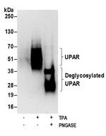 UPAR Polyclonal Antibody