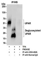 UPAR Antibody in Immunoprecipitation (IP)