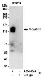 Nicastrin Antibody in Immunoprecipitation (IP)
