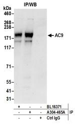 AC9 Antibody in Immunoprecipitation (IP)