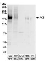 AC9 Antibody in Western Blot (WB)
