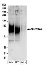 SLC26A2 Polyclonal Antibody