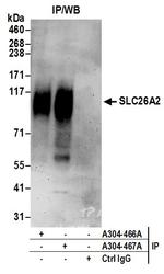 SLC26A2 Polyclonal Antibody
