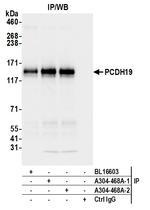 PCDH19 Antibody in Immunoprecipitation (IP)