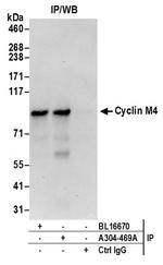 Cyclin M4 Antibody in Immunoprecipitation (IP)