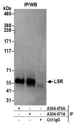 LSR Polyclonal Antibody
