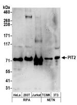 PIT2 Polyclonal Antibody