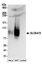 SLC6A15 Polyclonal Antibody
