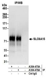 SLC6A15 Antibody in Immunoprecipitation (IP)