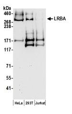 LRBA Polyclonal Antibody