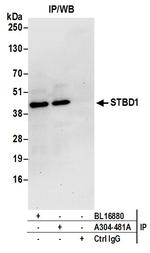 STBD1 Antibody in Immunoprecipitation (IP)