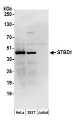 STBD1 Polyclonal Antibody