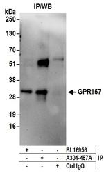 GPR157 Antibody in Immunoprecipitation (IP)