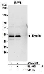 Emerin Antibody in Immunoprecipitation (IP)