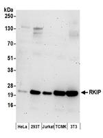 RKIP Polyclonal Antibody