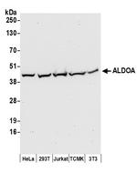 ALDOA Polyclonal Antibody